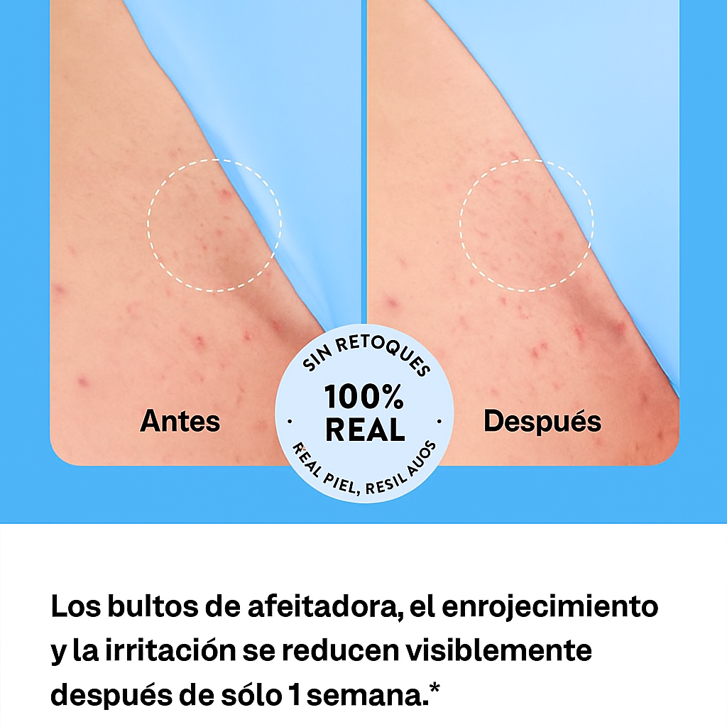 ROLLON PARA PIEL IRRITADA (OFERTA 2X1)